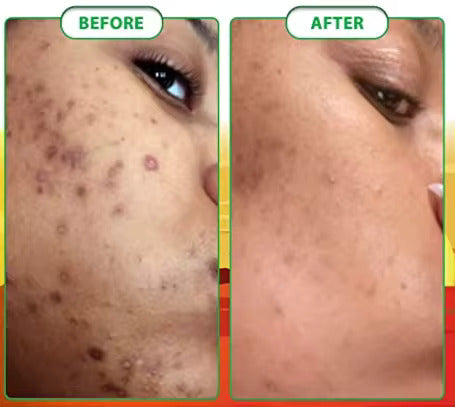 Glow Bright Turmeric Soap